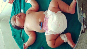 19-Year-Old Woman Gives Birth to the Heaviest Ever Baby Girl