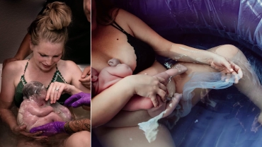 En Caul Births: 25 Rare Photos of Babies Born in the Amniotic Sac