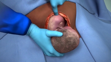 Cesarean Section Delivery Simulator