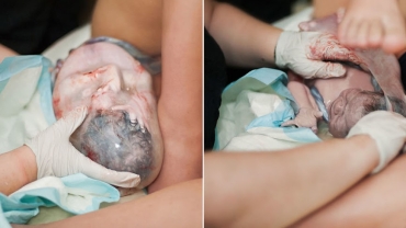 Extraordinary Photos of Babies Born in the Amniotic Sac