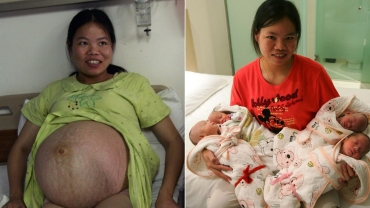 Farmer Woman Gives Birth to Quadruplets in China