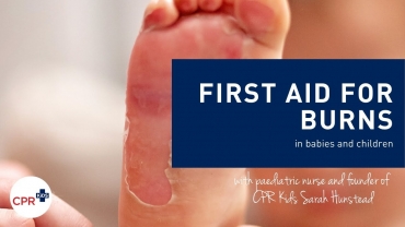 First Aid for burns in children