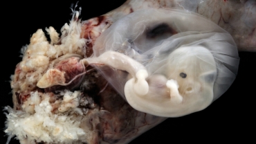 Incredible Real Photos of the Unborn Babies Developing in the Womb