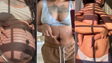 Mom Sharing Postpartum Body To Take On Society’s Ridiculous Expectations
