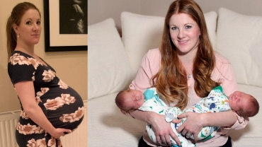 Mom With Giant Baby Bump Gives Birth To The Heaviest Twins In Scotland's History