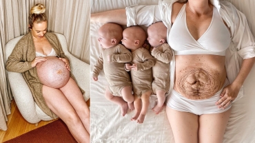 <p><strong><img alt="Mom of Triplets Shows off Her Pre and Post-birth Belly" src="https://lh3.googleusercontent.com/pw/AM-JKLW96QB4hK4x5_dcMWIt6pLEdnHTAoK05NhOVTh3Dt40doF_WDhY__z5iQh_IPOUrIRb5yQllwHhbkANpcCAbgIiDOtjIJAA1pQdN0EnDIzGivzsxj7lnRh4-sYsQARdxO1SmigzqhwfN6Nb9nPCGAvp=w1006-h566-no?authuser=0" style="width: 100%" />&nbsp;</strong><a href="https://www.instagram.com/michellameiermorsi/"><span style="color:#696969; font-size:11px;">Photo credits: Michella Meier-Morsi</span></a></p>