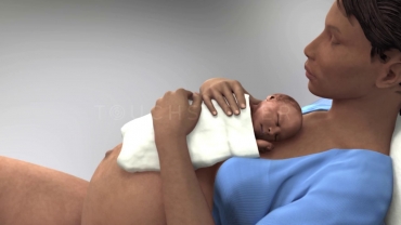 Patient Education Animation: Natural Childbirth