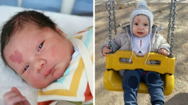 Love Baby: Baby Born With A Heart Shaped Birthmark