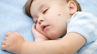 Baby Care: How to Treat Bug Bites?