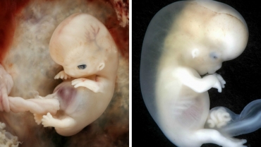 Baby in the Womb: Real Footage of Developing Fetus