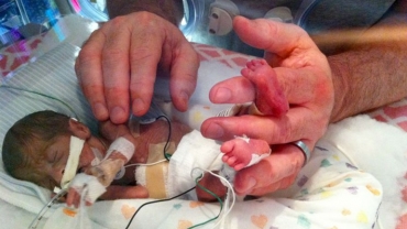 Born 4 Months Early, This Tiny Survivor Beats the Odds