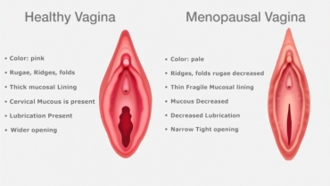 Empower Yourself with Facts on Vaginal Wellness
