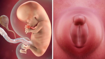  Girl or Boy: How Baby's Genitals Develop?