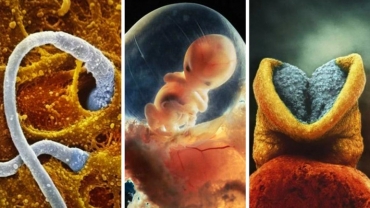 How a Child is Born: Incredible Photos of a Baby Developing in the Womb