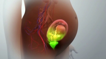 How Does Prenatal Radiation Exposure Affect Unborn Babies?