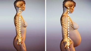 How Pregnancy Causes Posture Changes?