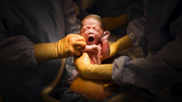 How to Have a Positive Cesarean Delivery
