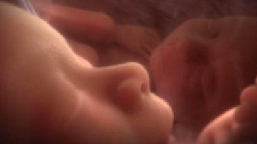 Inside the Womb: Acrobatic Fetus