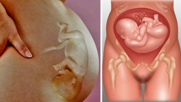 Last Month of Pregnancy: Baby Positions in the Womb