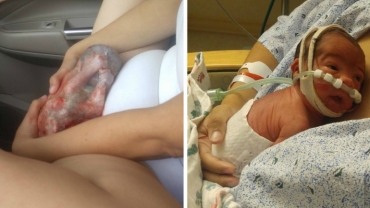 Woman Delivers Baby Still in Its Amniotic Sac While En Route to Hospital