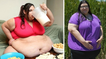 Morbidly Obese Pregnant Woman Loses Weight After Two Miscarriages