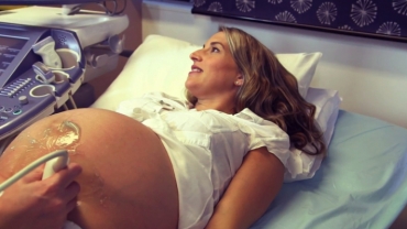 Obstetric Ultrasound Guide: Ultrasound Scanning in Pregnancy