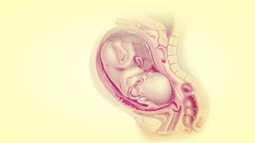 Placenta Accreta: Diagnosis, Risks and Recovery