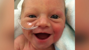 Premature Baby Girl Smiling 5 Days After Birth