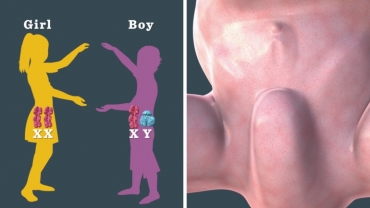 The Process by Which Your Baby Becomes a Boy or a Girl