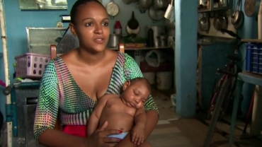 Zika Virus Linked to Birth Defect in Newborn Babies