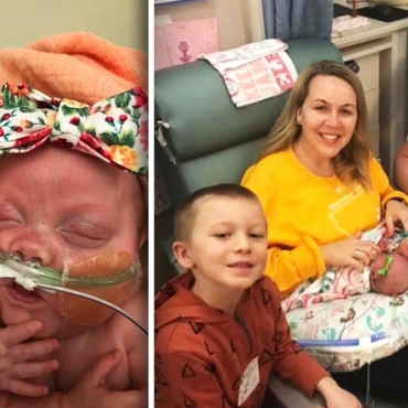 Preemie Twins Born at 22 Weeks Are Breaking Records