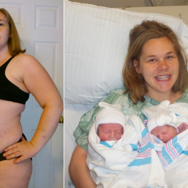 The Good, Bad, and Ugly of a Triplet Pregnancy