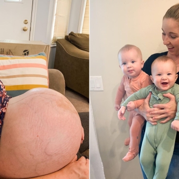 Triplets' Mother Shares Amazing Before & After Pregnancy Photos