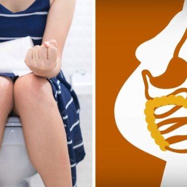 Constipation in Pregnancy: Tips for Preventing and Easing the Discomfort