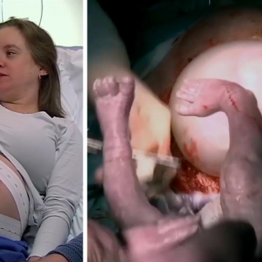 Giving Birth to Twins