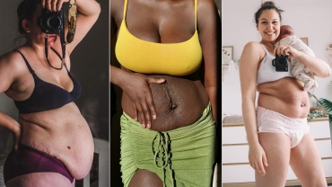 32 Stunning Photos That Show How Different Postpartum Bodies Can Look