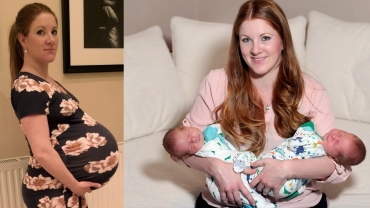 Mom With Giant Baby Bump Gives Birth To The Heaviest Twins In Scotland's History