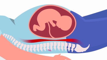 Safe and Comfortable Sleeping Positions During Pregnancy