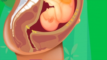 What Happens During Labor Contractions?