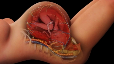 Decreased Fetal Oxygen Delivery