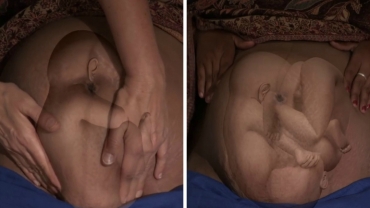 Different Positions of a Baby in the Womb