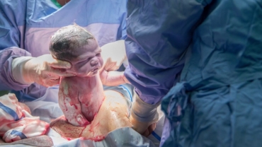 Gentle C-section: Liam's Birth Story