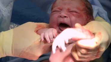 Giving Birth by Cesarean Section: All You Need to Know