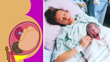 How Does a Woman Give Birth?