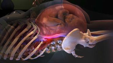 How When Pregnant the IVC Can Be Compressed?