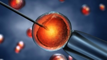 Intracytoplasmic Sperm Injection (ICSI)