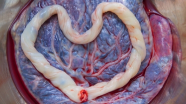Researchers Probe Mysteries of the Placenta