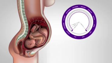 Syphilis Infection in Pregnancy