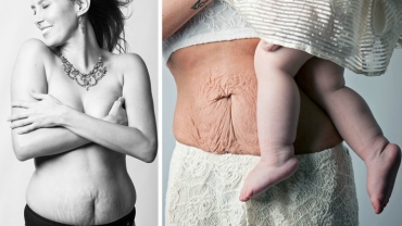 What Women's Bodies Really Look Like After Childbirth