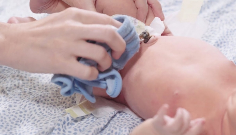 How to Care for a Baby’s Umbilical Cord?